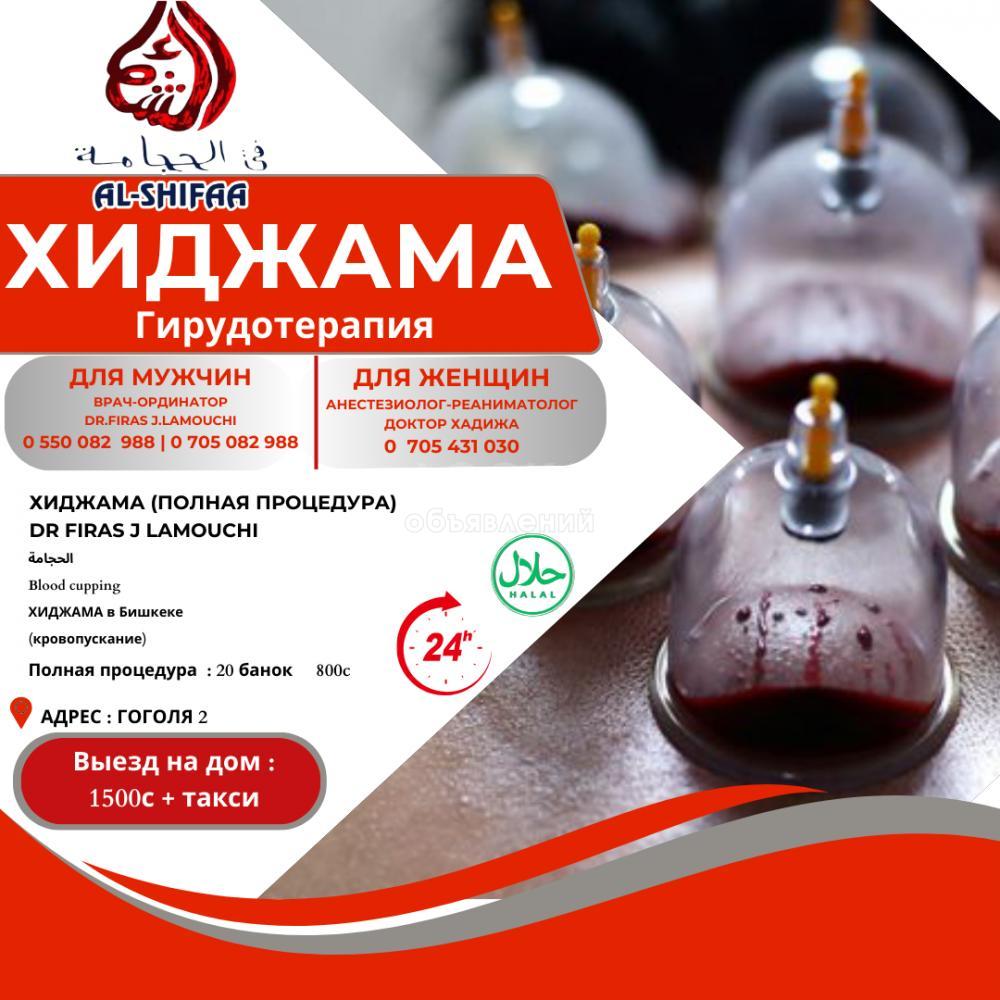 Хиджама (кровопускание) в Бишкеке: полная процедура 20 банок всего за 800с!