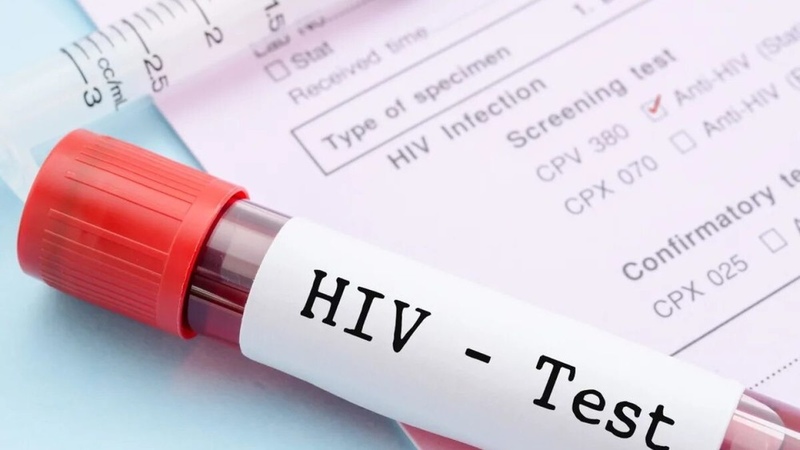 HIV incidence grows in Kazakhstan - Ministry of Health - Vimarsana News