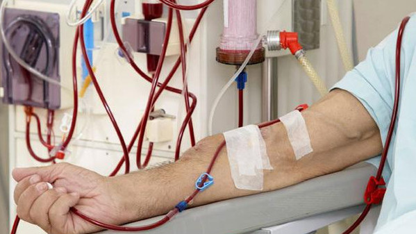 10 dialysis machines purchased on money from President's Fund - Vimarsana News