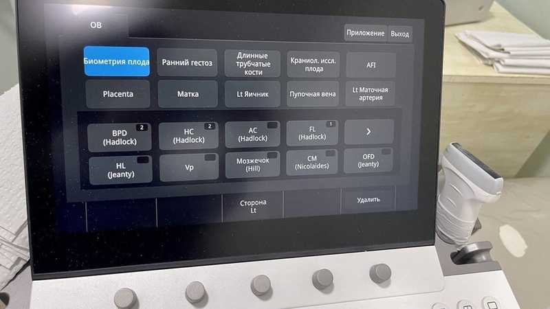 Ultrasound Machine With Built-in Ai Used In At-bashi District General 