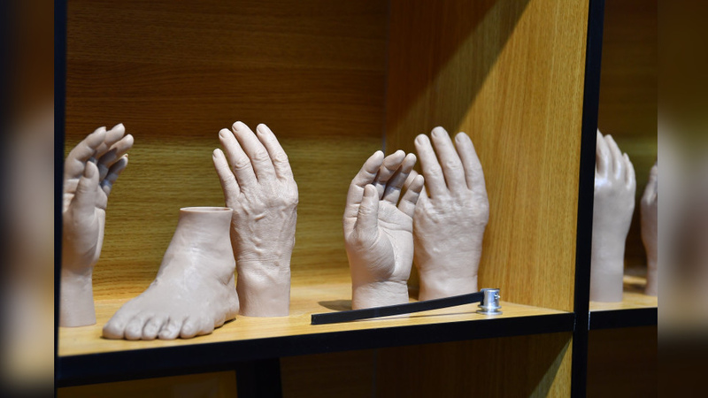 First laboratory for cosmetic prosthetics opens in Mongolia