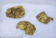 A stash of 2,800-year-old gold jewellery has been unearthed by archaeologists in Kazakhstan. Some 3,000 golden and precious items were found in a burial mound in the remote Tarbagatai mountains. The treasure trove is believed to belong to royal or elite members of the Saka people who held sway in Central Asia eight centuries before the birth of Christ.