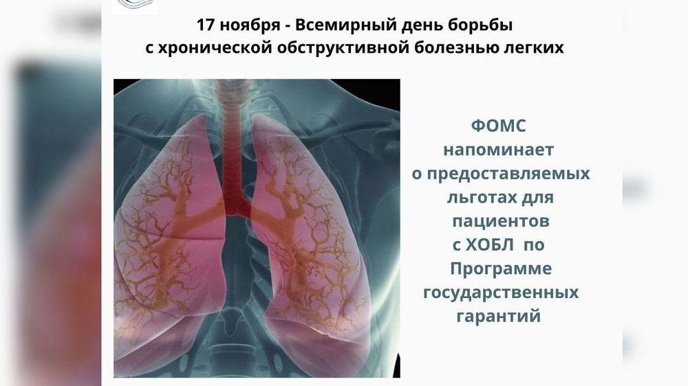 50 легких. Всемирный день борьбы с хронической обструктивной болезнью легких. День борьбы с ХОБЛ. Хронические заболевания легких в Кыргызстане. Силикатная болезнь легких.