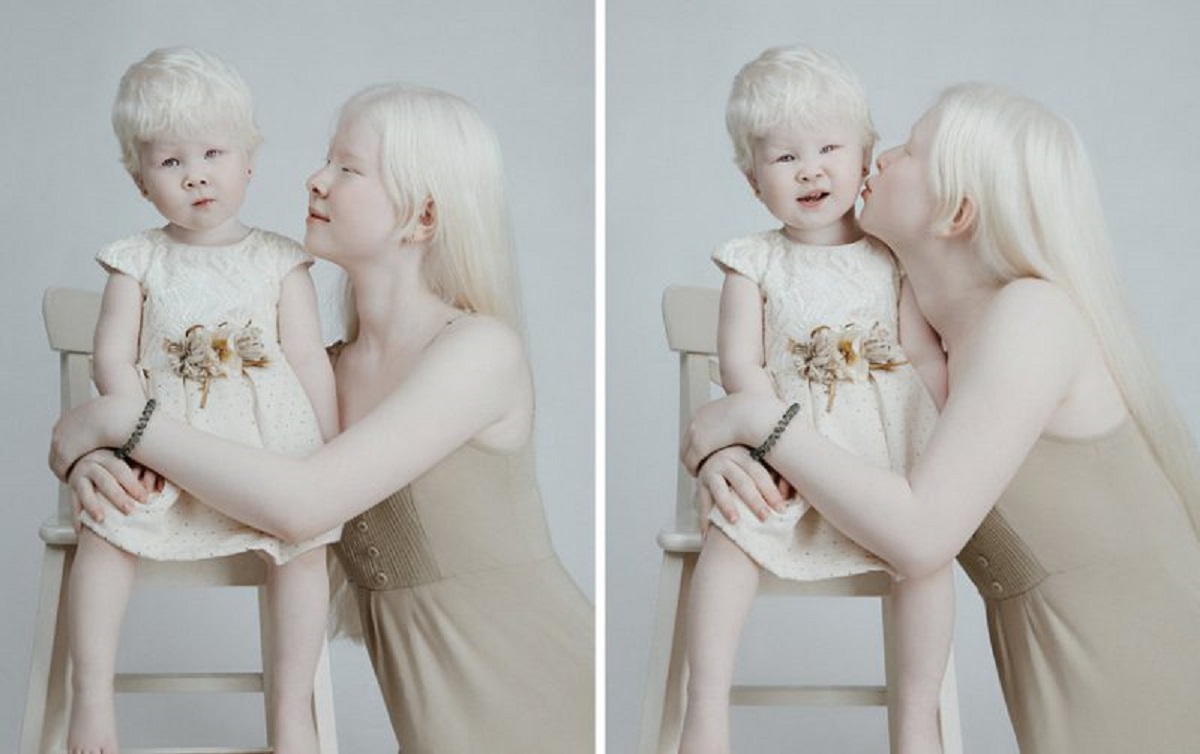 Амелия ньюсхэм альбинос