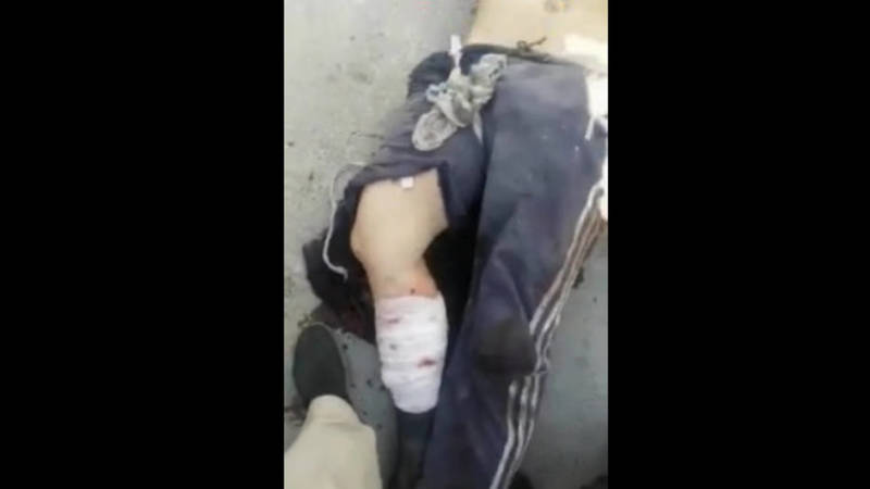«Нога разорвана, пулевое ранение в бок». Видео пострадавших на границе