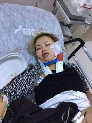 Девушка из Кыргызстана впала в кому в Анталии, помогите найти родных, - читатель <i>(фото)</i>
