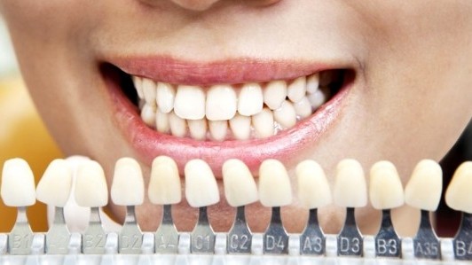Почему желтеют зубы и как это исправить
